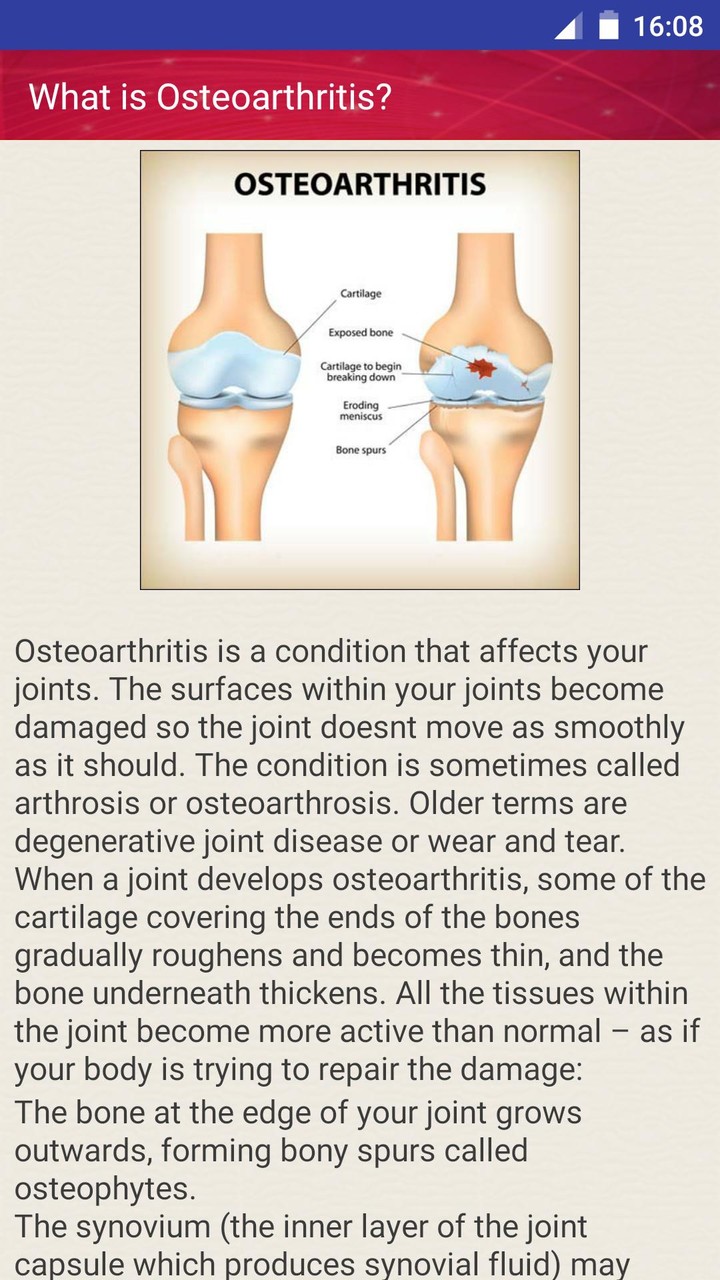 Osteoarthritis Joint Pain Treatment Home Remedies